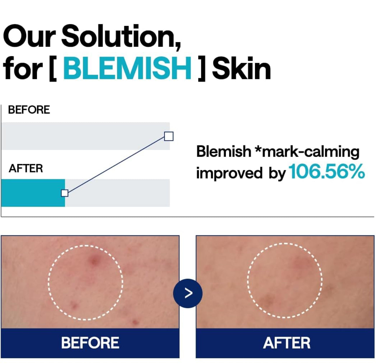 Madecassoside Blemish Pad Ampoule (40ml)