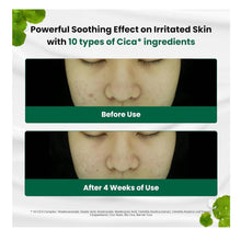 Load image into Gallery viewer, Dr.G R.E.D Blemish Cream infographic – features 10 types of Cica and 100-hour hydration