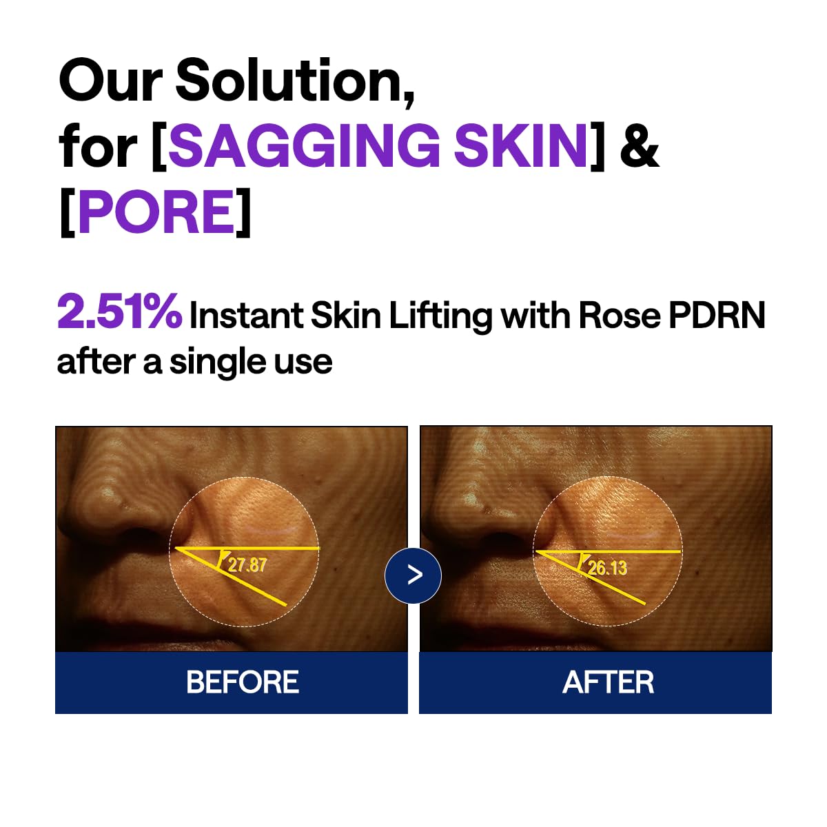 PDRN Lifting Serum (40ml)