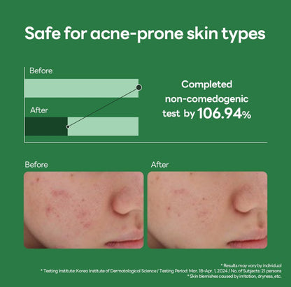 [MEDIHEAL] Teatree Calming Hydra Serum (50ml)