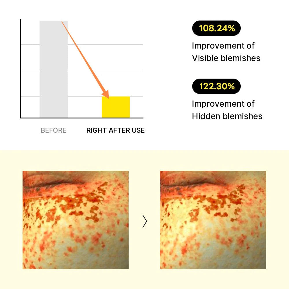 [MEDIHEAL] Vita Collagen Eye Ampoule Patch (60pcs)