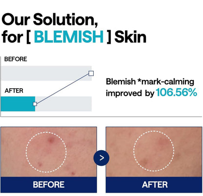 [MEDIHEAL] Madecassoside Blemish Pad Ampoule (40ml)