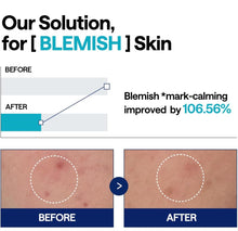 Load image into Gallery viewer, [MEDIHEAL] Madecassoside Blemish Pad Ampoule (40ml)
