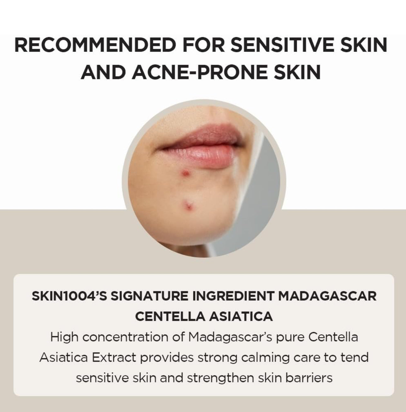 [SKIN1004]Madagascar Centella Ampoule (100ml)