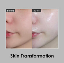 Load image into Gallery viewer, [Medi-Peel] Bio-Intense Glutathione Ampoule, 30ml | 3-1in Ampoule | Wrinkle Repair | Anti-Aging | Radiant Skin | Reduce Dark Spots
