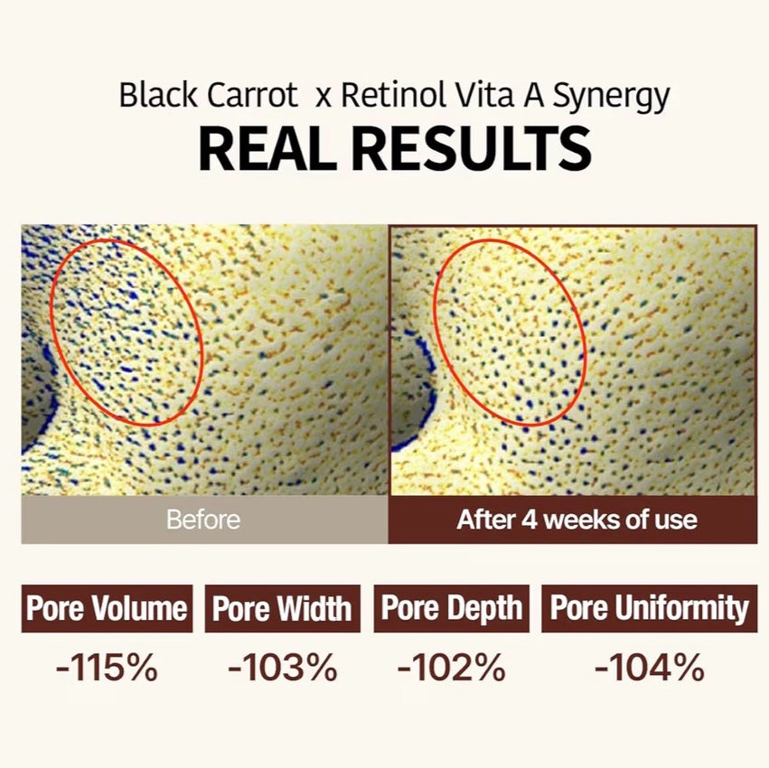 Black Carrot VITA-A Retinol Ampoule (30ml)
