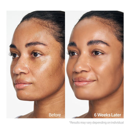 Kojic Acid Niacinamide Radiance Soothing Gel Cleanser (120g)