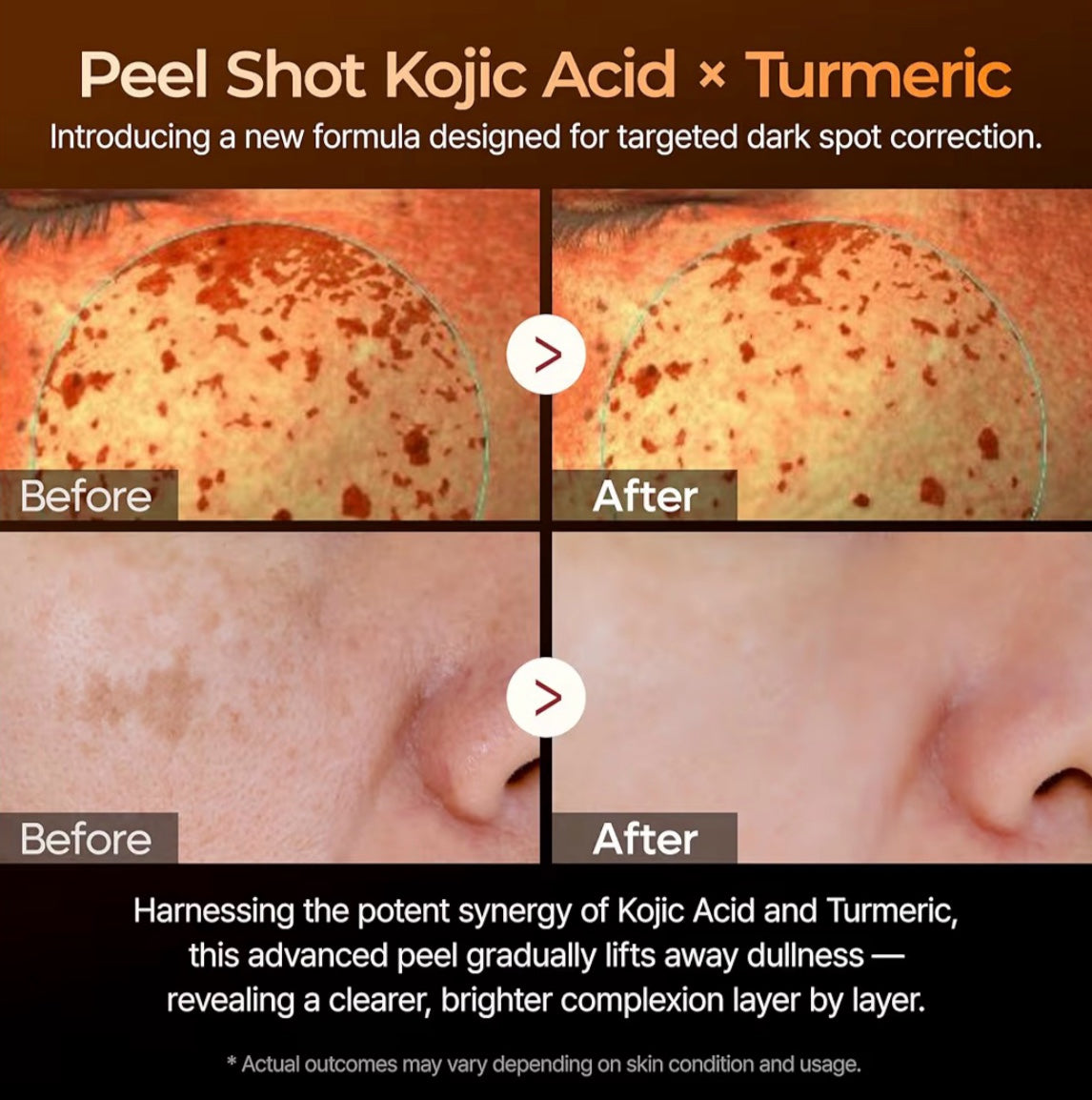 Peel Shot Kojic Acid Turmeric Serum (80ml)