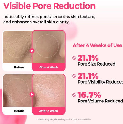 Cyano Pink Spicule Niacinamide Serum (30ml)