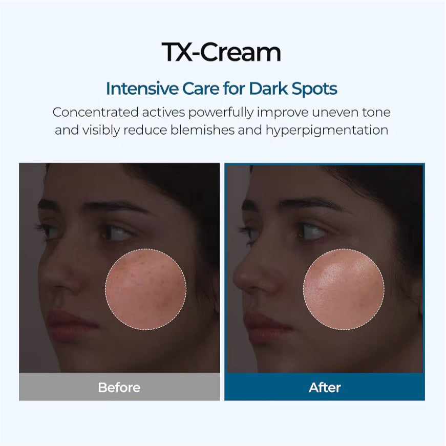 TX Cream Tranexamic Acid + Niacinamide (50g)