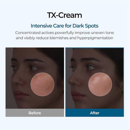 TX Cream Tranexamic Acid + Niacinamide (50g)