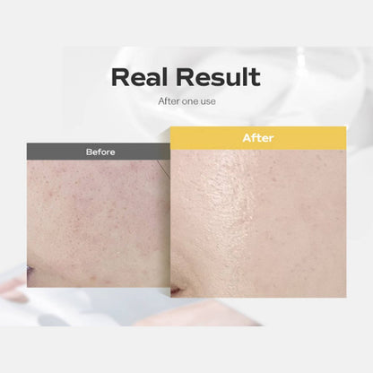 Deep Collagen Niacin-Vita C Brightening Mask (1 Sheet)