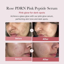 Load image into Gallery viewer, [medicube] PDRN Pink Peptide Serum (30 ml / 1.01 fl oz)
