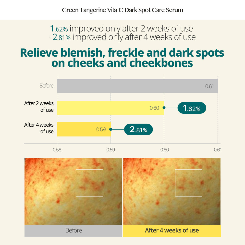 [GOODAL ] Green Tangerine Vita C Dark Spot Serum (40ml)