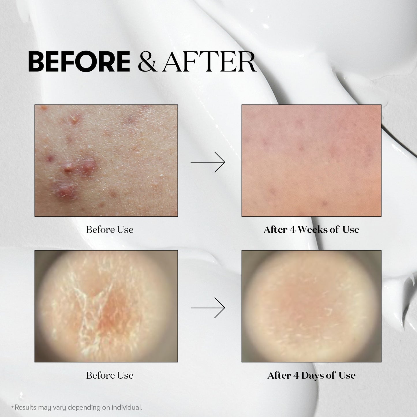 [VT] Reedle Shot 100 Boosting Ampoule (2ml × 6ea)