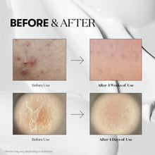 Load image into Gallery viewer, [VT] Cica x Hyalon Reedle Shot 100 (50ml)
