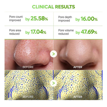 Cactox CT 3-Step Nose Pore Pack (3 Sheets)