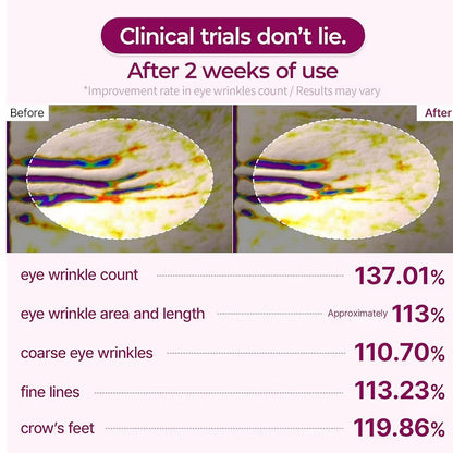 Calcium CX Cemenrete Calcium Volume Eye Patch 72g (60 Patches)