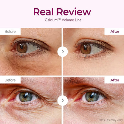 Calcium CX Cemenrete Calcium Volume Eye Patch 72g (60 Patches)