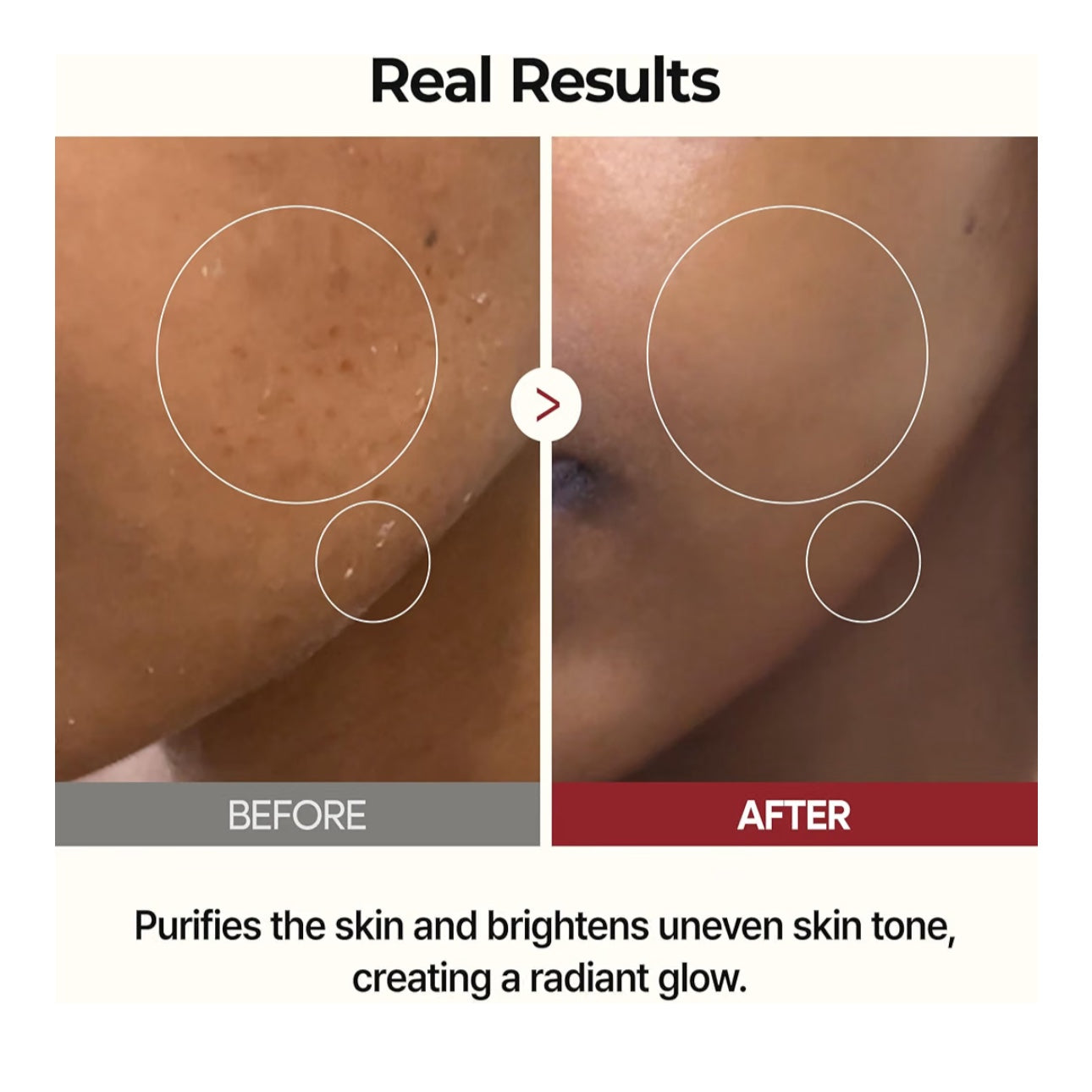 Peel Shot Glow White Rice Toner 200ml