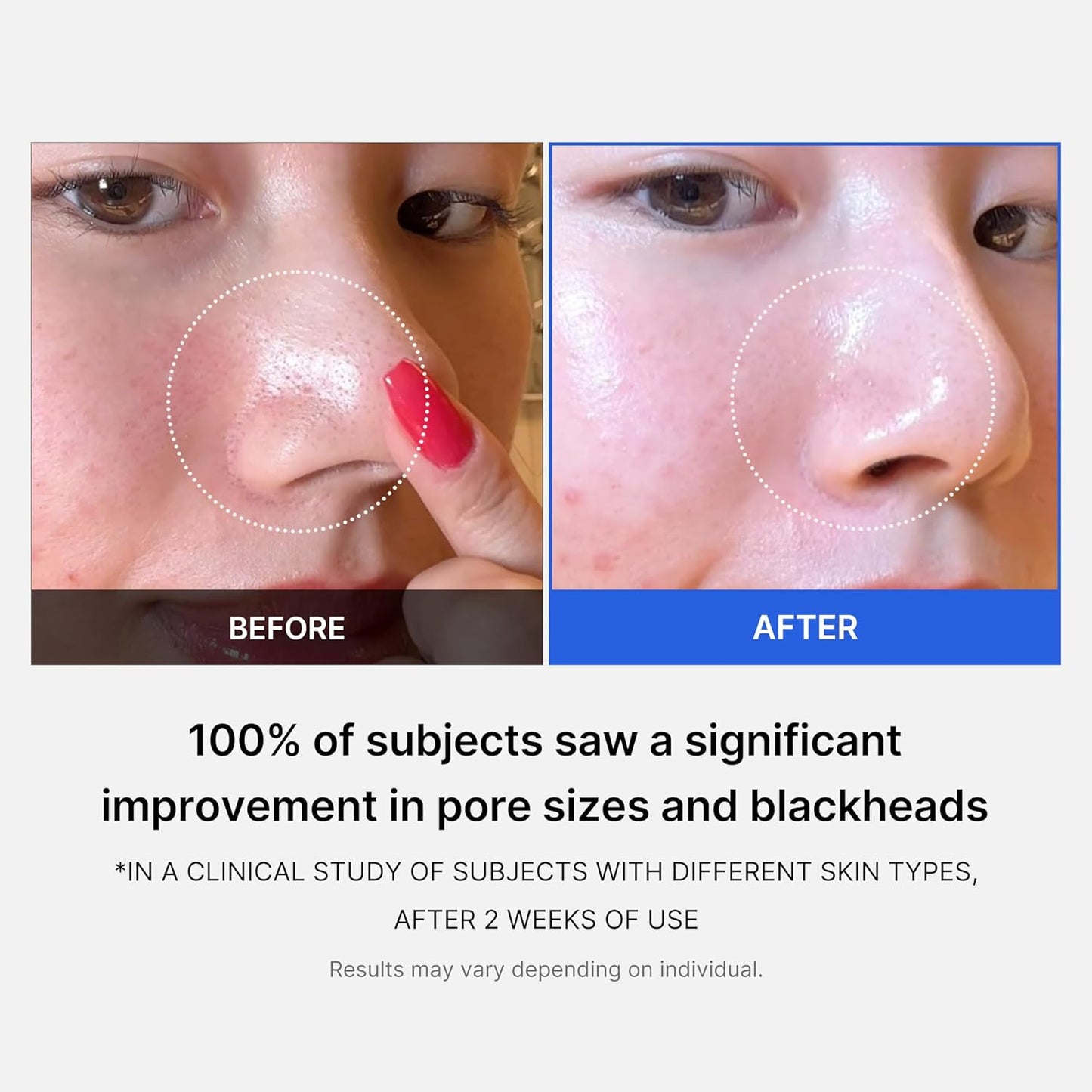 [medicube] Zero Pore Pad (70 pads)
