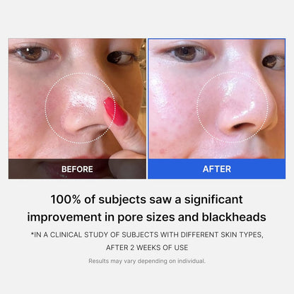 [medicube] Zero Pore Pad (70 pads)