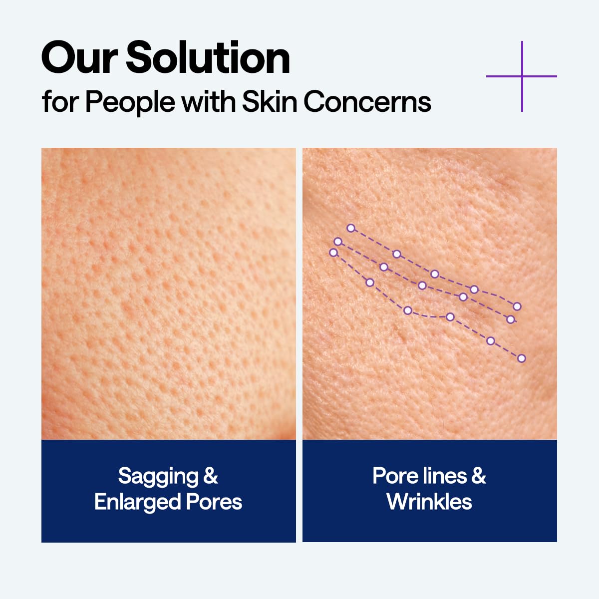 [MEDIHEAL] PDRN Lifting Serum (40ml)