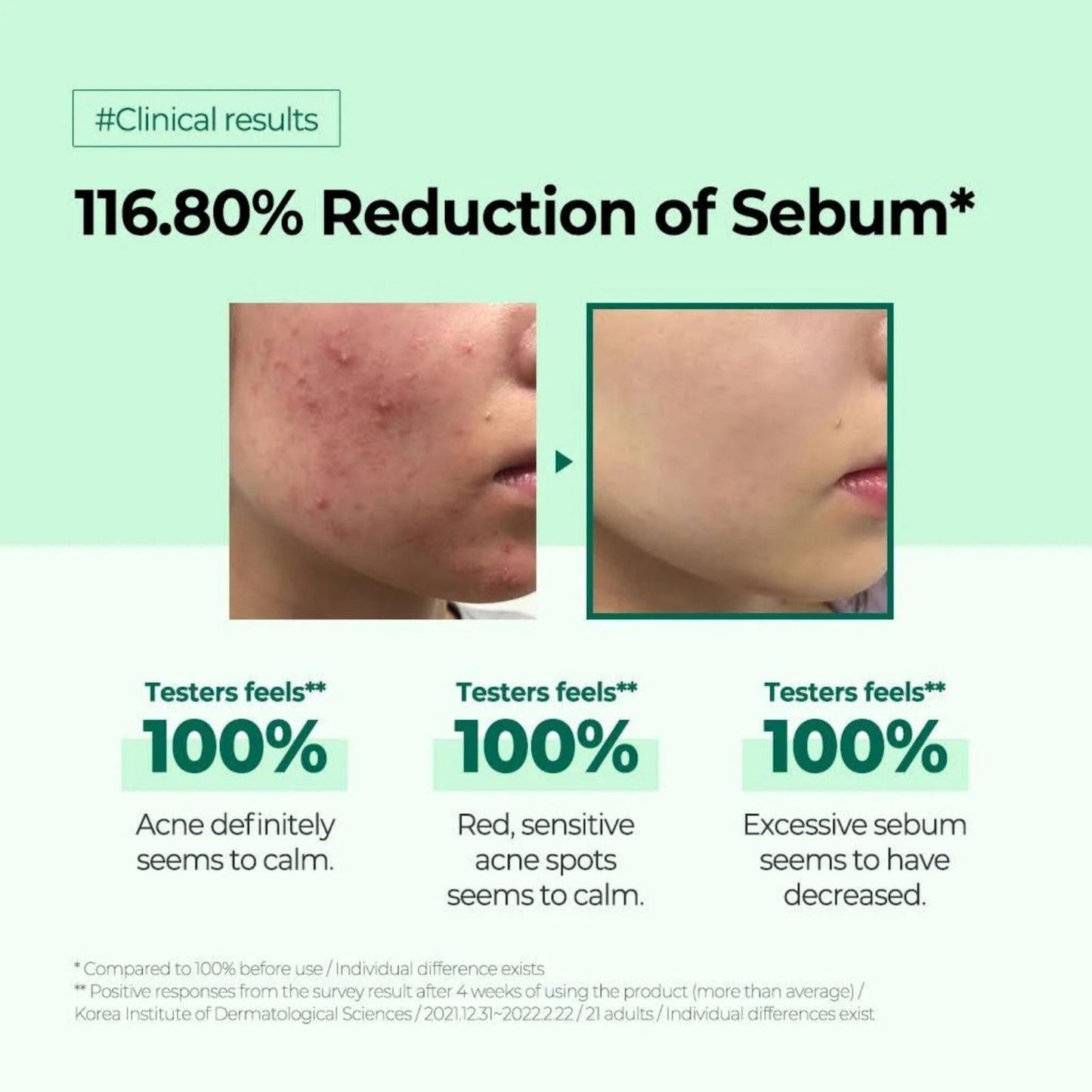 AHA·BHA·PHA 30 Days Miracle Toner (150ml)