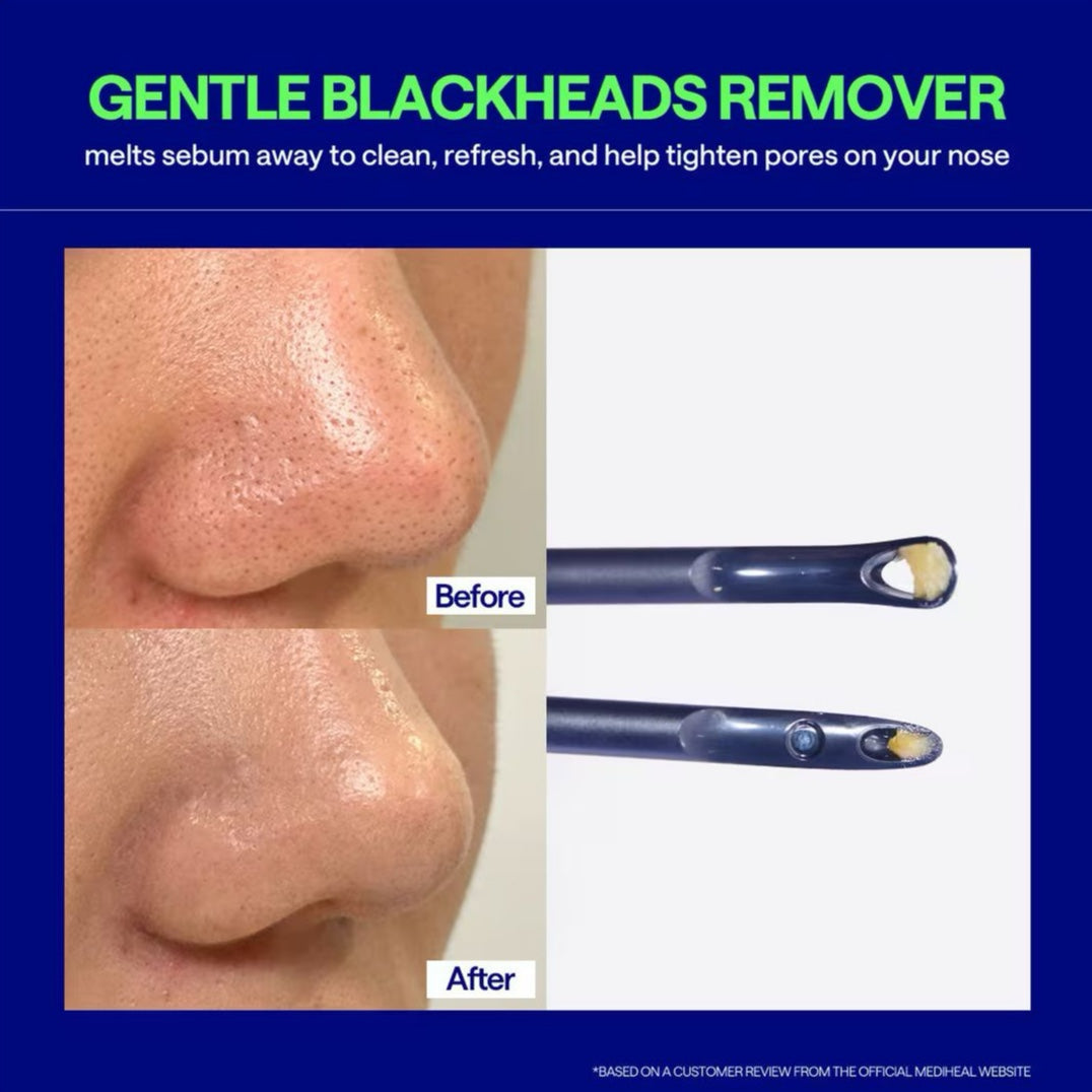 Blackhead Melting Clear Nose Patch