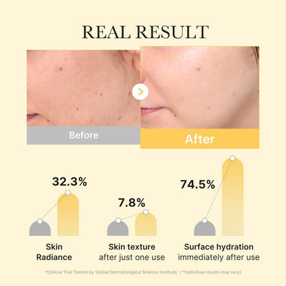 Kojic Acid Turmeric Gel Mask (4 Sheets Box)